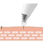 Xiaomi InFace Blackhead Remover 9